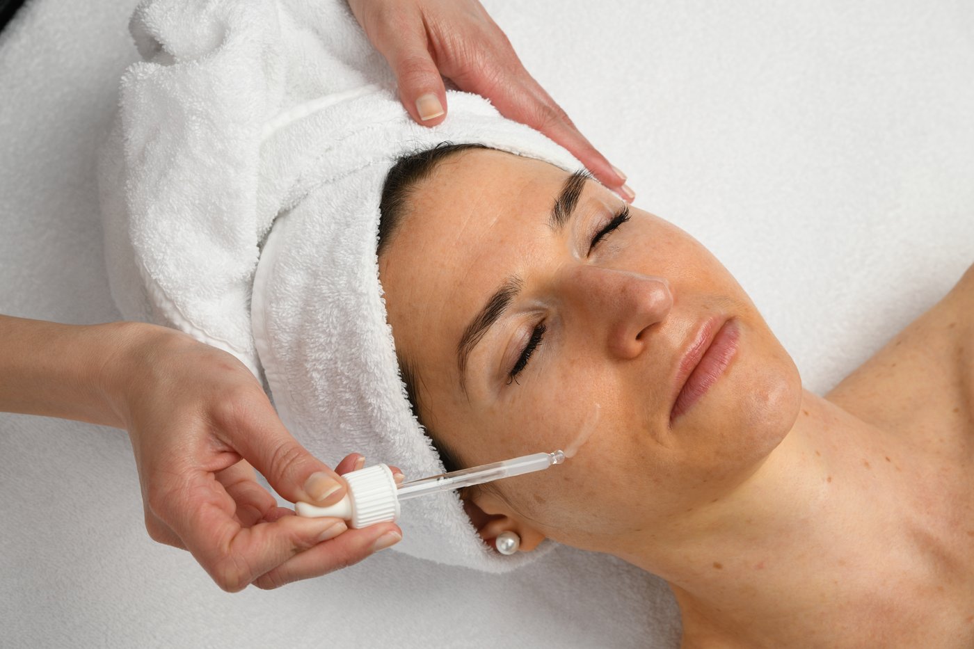 Expert Acids Peeling